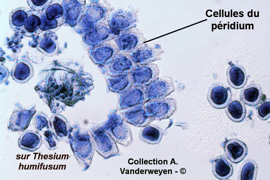 Aecidium thesii (Puccinia passerinii)