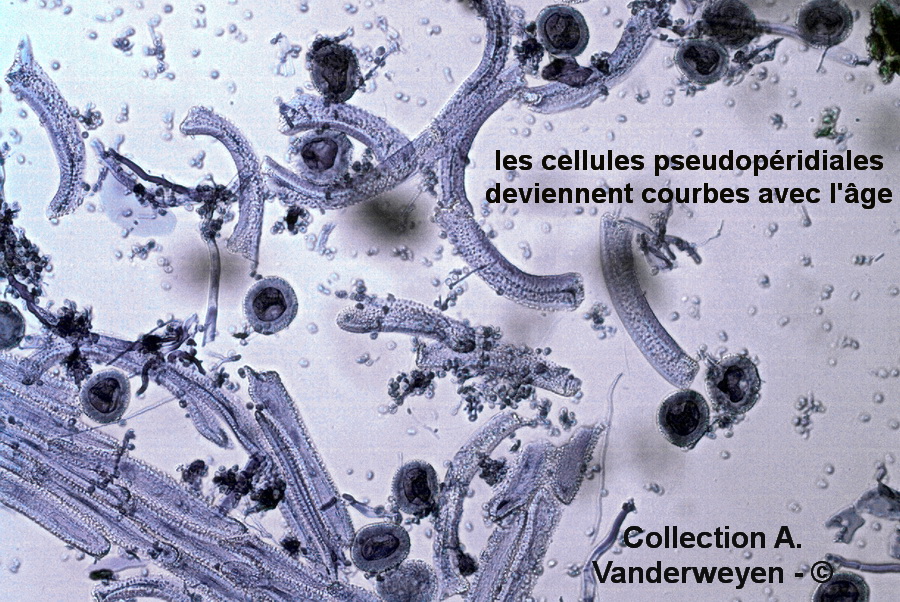 Gymnosporangium clavariiforme