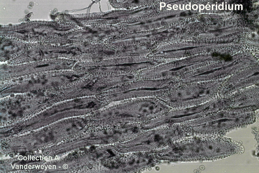 Gymnosporangium clavariiforme