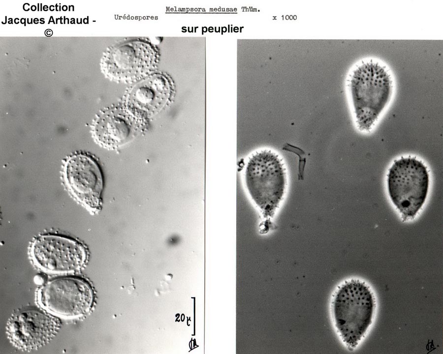 Melampsora medusae