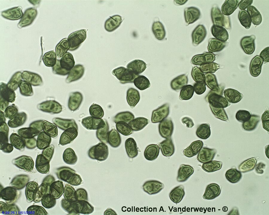 Puccinia adoxae