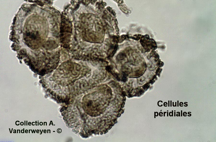 Puccinia bulbocastani