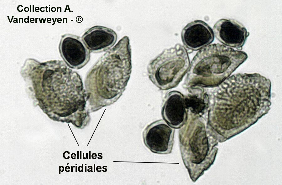 Puccinia dioicae