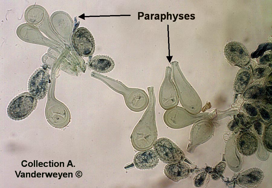 Puccinia magnusiana