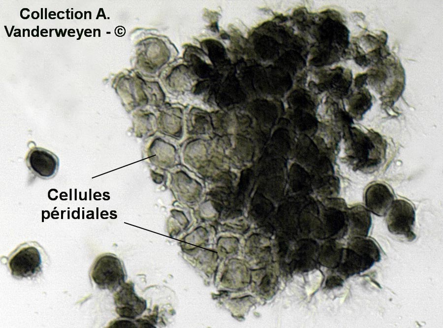 Puccinia sessilis