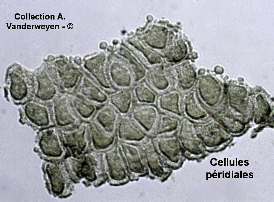 Puccinia thesii