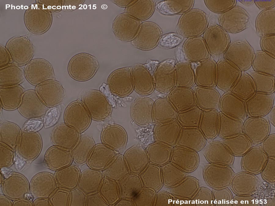 Uromyces-appendiculatus
