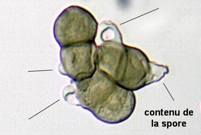 Bulles hyalines et difformes contre les spores