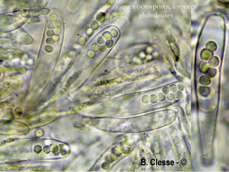 Bryocentria brongniartii