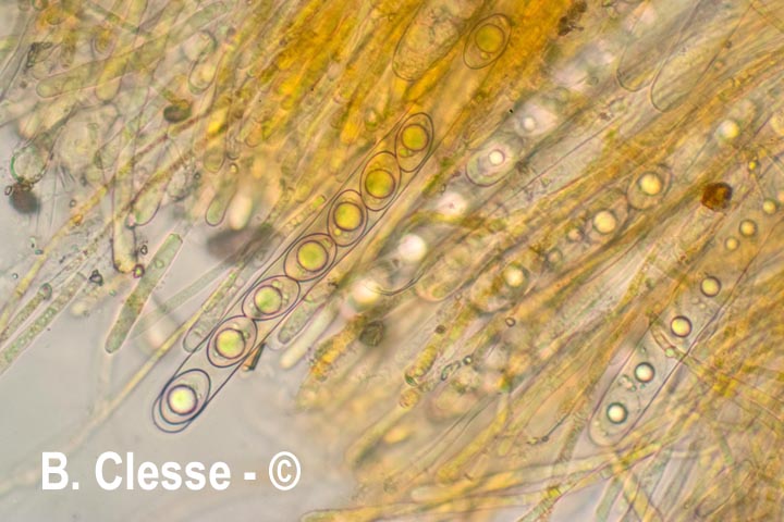 Octospora excipulata