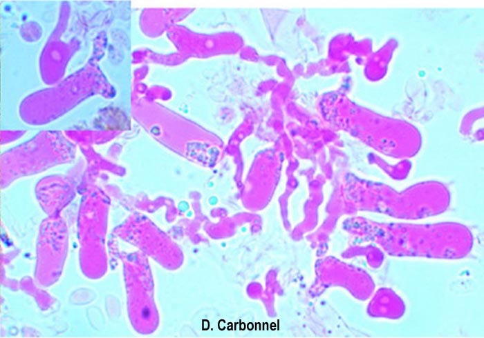 Aphanobasidium pseudotsugae