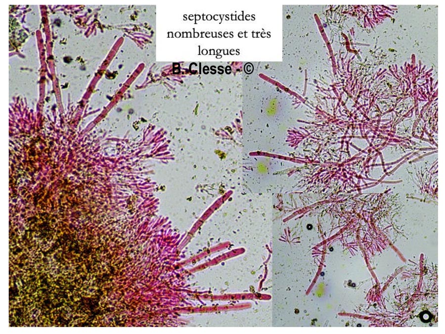 Candelabrochaete septocystidia