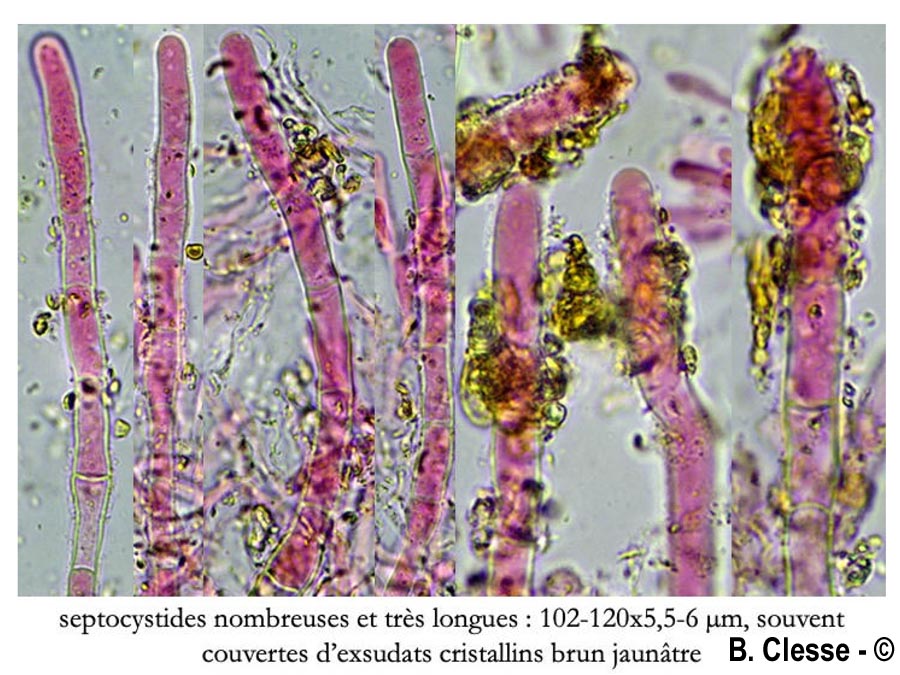 Candelabrochaete septocystidia