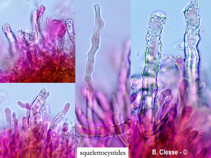 Etheirodon fimbriatus (Steccherinum fimbriatum)