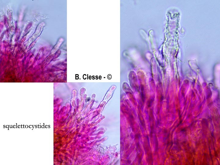 Etheirodon fimbriatus (Steccherinum fimbriatum)