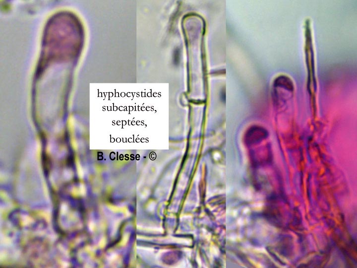 Hyphodontia arguta