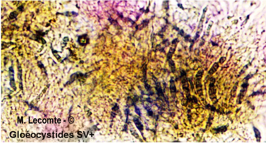 Megalocystidium leucoxanthum