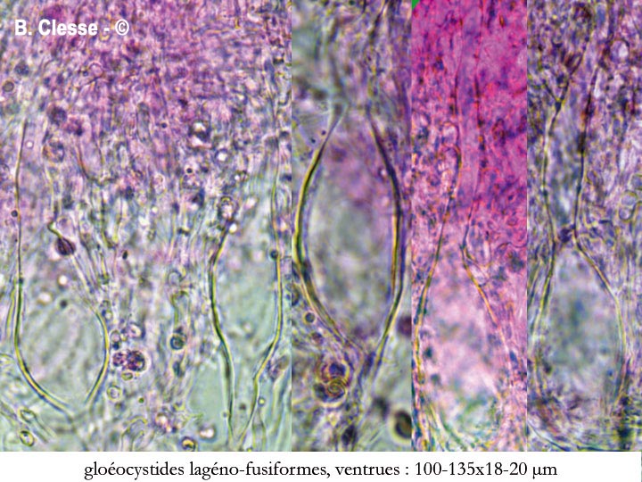 Vesiculomyces citrinus (Gloiothele citrina)
