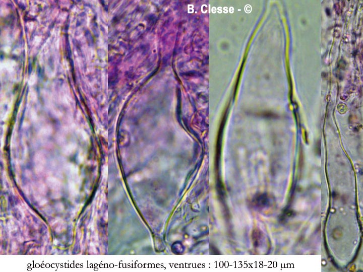 Vesiculomyces citrinus (Gloiothele citrina)