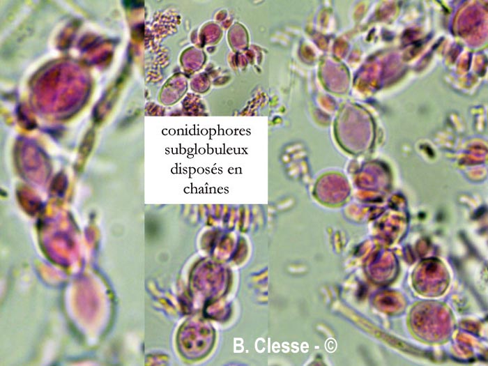 Ascocoryne albida