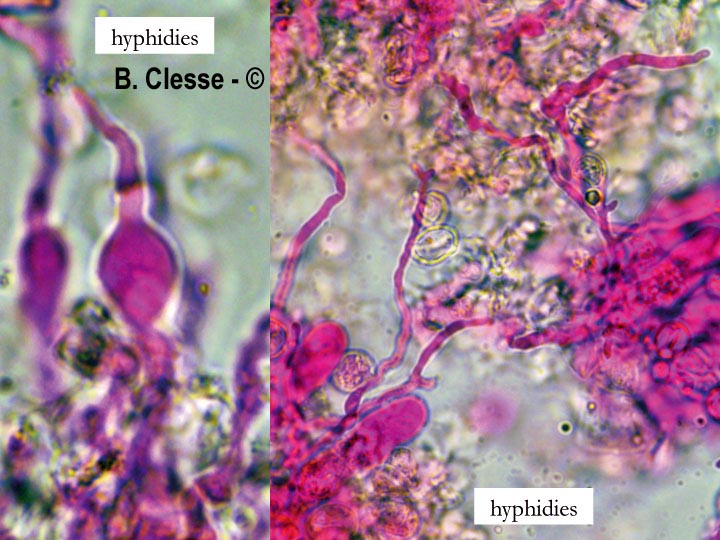 Radulomyces rickii