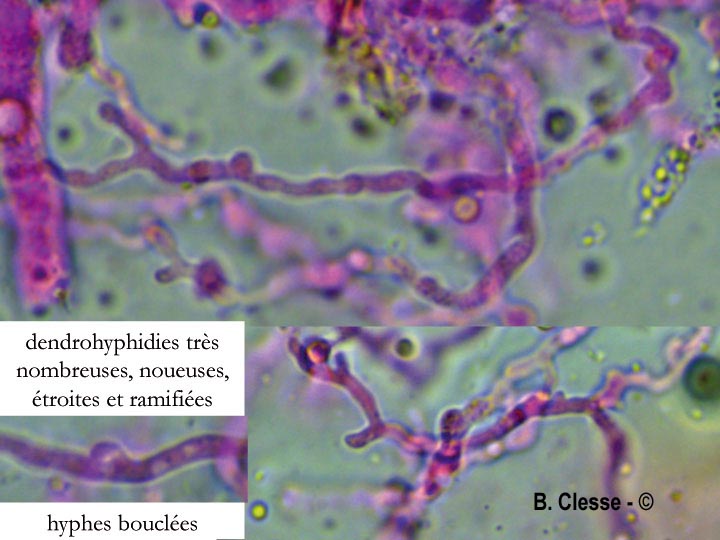 Vuilleminia coryli