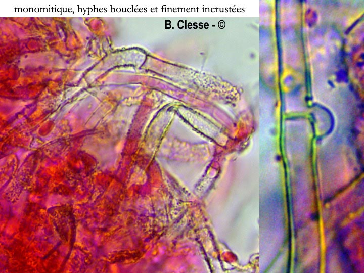 Amphinema byssoides