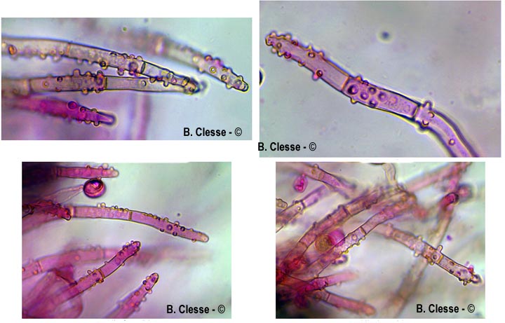 Botryobasidium conspersum