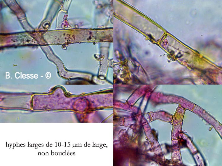 Botryobasidium laeve