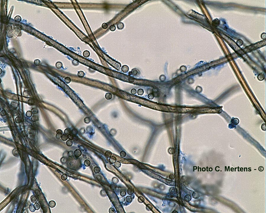 Bovista pusilla (Lycoperdon dermoxanthum)