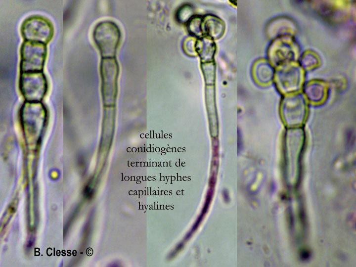 Cheirospora botryospora