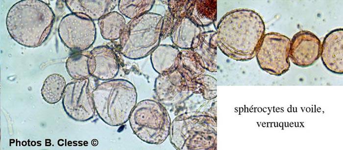 Coprinopsis laanii