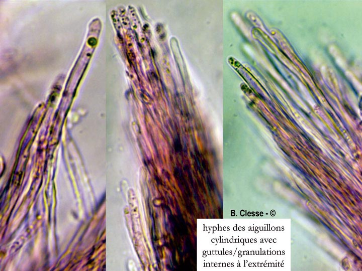 Fibrodontia gossypina (Hyphodontia gossypina)