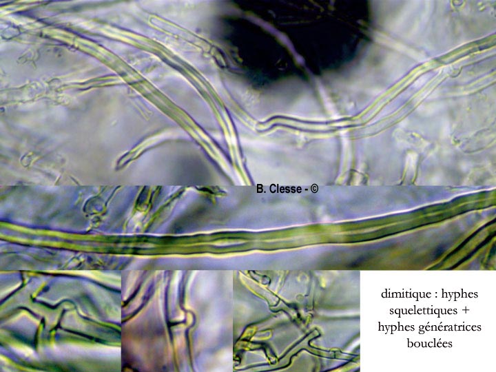 Fibrodontia gossypina (Hyphodontia gossypina)