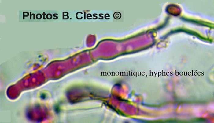 Hyphodontia alutaria