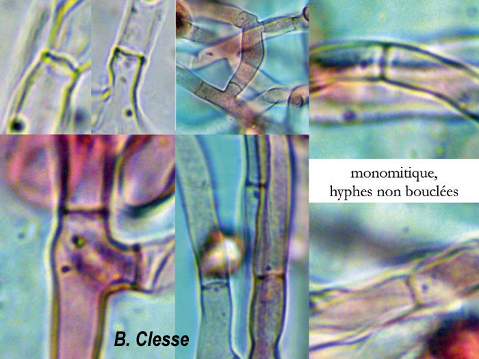 Lindtneria trachyspora