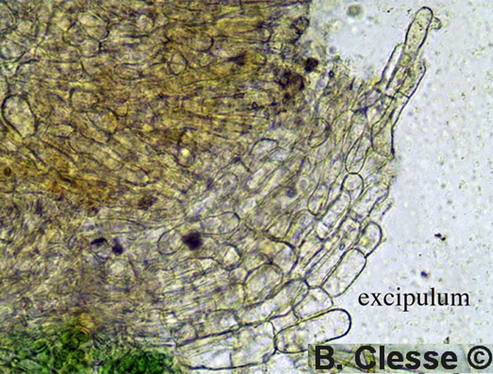 Octospora musci-muralis