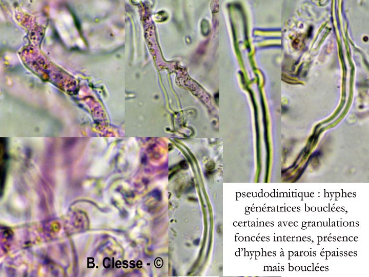 Phlebia diffissa