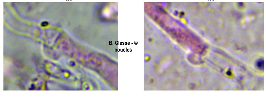 Phlebia rufa