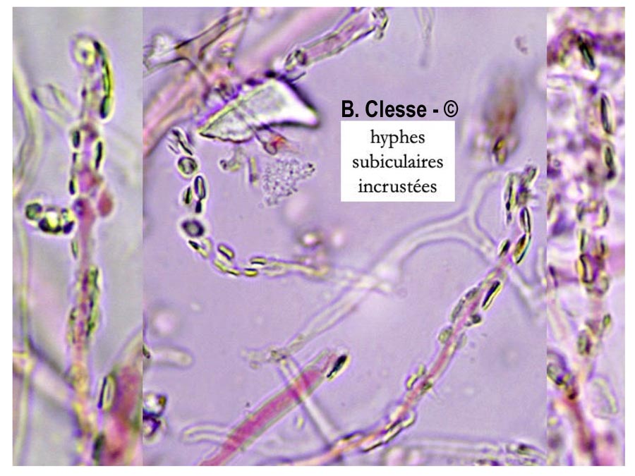 Xenasmatella fibrillosa (Phlebiella fibrillosa)