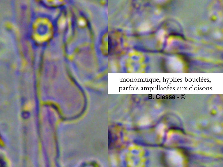 Trechispora farinacea