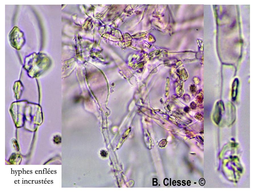 Trechispora hymenocystis