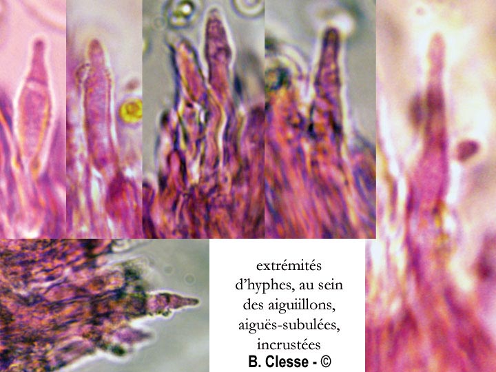 Xylodon pruni (Hyphodontia pruni)