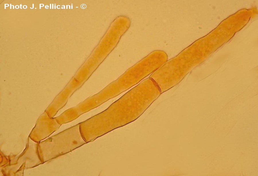 Morchella esculenta var. vulgaris