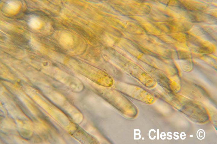 Octospora excipulata