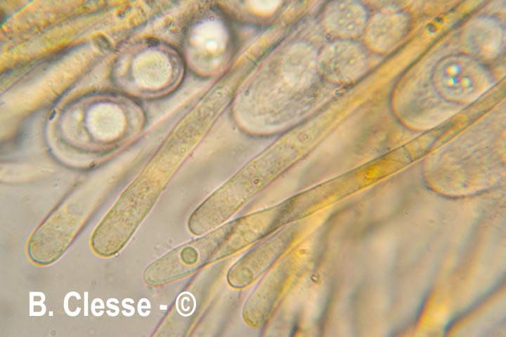 Octospora excipulata