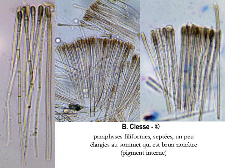 Pseudoplectania nigrella