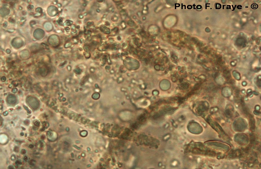 Tricholoma roseoacerbum