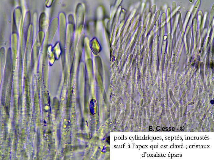 Dasyscyphella nivea