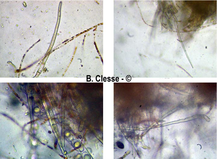 Neottiella vivida